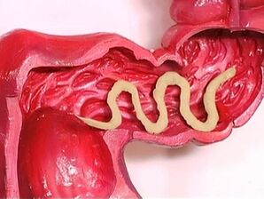 Parasieten in het menselijk lichaam waarom ze verschijnen