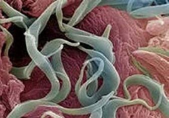 Symptomen en behandeling van parasieten in het menselijk lichaam