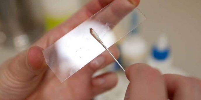 huidschrapen op parasieten