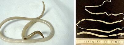 soorten parasieten in het menselijk lichaam