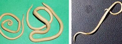 welke parasieten kan een mens hebben