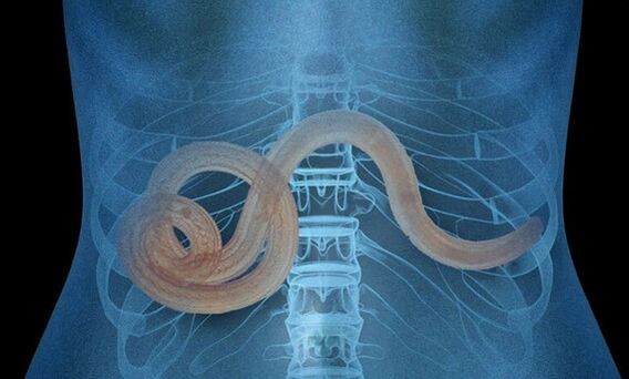 parasiet in het menselijk lichaam