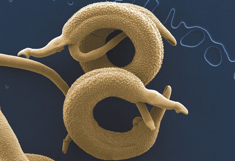 parasieten die in het menselijk lichaam leven